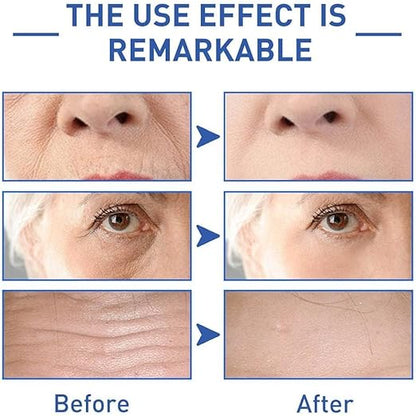 SADOER Retinol & Caffeine Anti-Wrinkle Eye Cream | Dark Circles & Puffiness Care