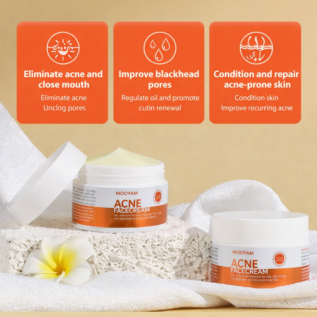 Mooyam Acne Face Cream (100g) – Anti-Acne Treatment, Oil Control & Skin Renewal