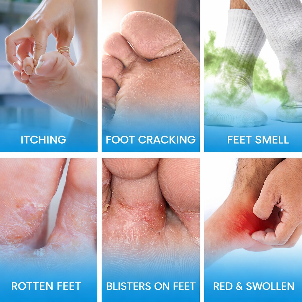 Sumifun Foot Antibacterial Cream with Tea Tree Oil – Antifungal, Anti-Itch & Skin Repair Cream for Athlete’s Foot, Ringworm & Irritated Skin (20g)