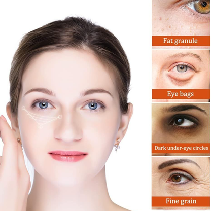 Milia Remover Essential Eye Serum | Gentle Hydration, Oil Control & Skin Smoothing Care