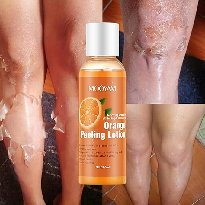 Mooyam Orange Peeling Lotion for Whitening & Dead Skin Removal – Exfoliating Body Lotion with Orange Extract for Smooth, Bright Skin (100ml)