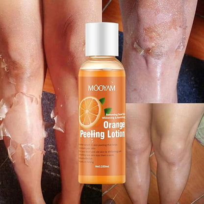 Mooyam Orange Peeling Lotion for Whitening & Dead Skin Removal – Exfoliating Body Lotion with Orange Extract for Smooth, Bright Skin (100ml)