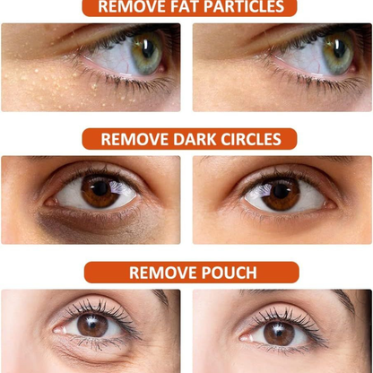 Milia Remover Essential Eye Serum | Gentle Hydration, Oil Control & Skin Smoothing Care